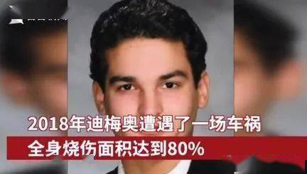 全球首例成功换脸换手男子将喜结良缘